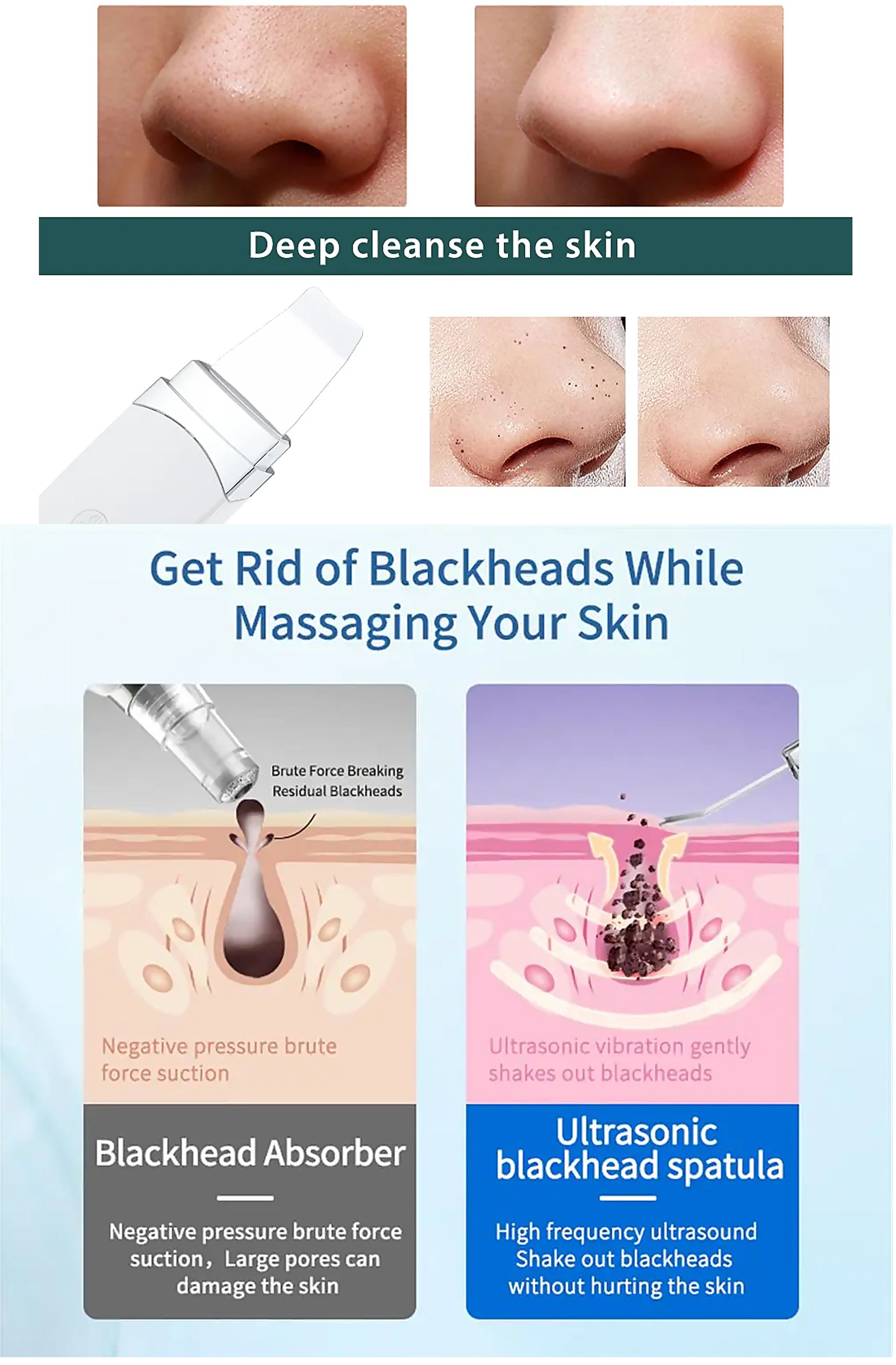 KALICY - Triple Function Lifting Exfoliator - Ultrasonic Treatment